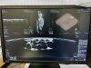 GE Invenia ABUS Automated Breast Ultrasound System