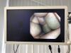 OLYMPUS PCF-H290ZI Colonoscope