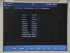 FUKUDA DENSHI PaoLus UF-760AG Portable Color Imaging System With Cart - 207942 Monitor