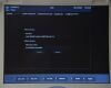 FUKUDA DENSHI PaoLus UF-760AG Portable Color Imaging System With Cart - 207942 Monitor