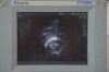 SONOSITE Titan High-Resolution Imaging System W/ C15/4-2 MHz &amp; Cart - 207959 Monitor