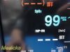 NIHON KOHDEN 2018  Lifescope BSM 6000 , W/ AY-653P Module & NEW Leads~ Monitor