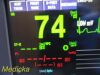 NIHON KOHDEN 2018  BSM-6301A BIS Ready , W/ AY-653P Module & NEW Lead~ Monitor