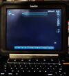SONOSITE Edge II Sonosite Edge II
