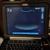 SONOSITE Edge II Sonosite Edge II