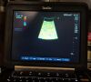 SONOSITE Edge II Sonosite Edge II