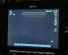 SONOSITE Edge II Sonosite Edge II