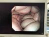 OLYMPUS GIF-1200N Gastroscope