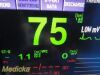 NIHON KOHDEN 2018  Lifescope BSM 6000 ,W/ AY-653P Module & Leads ~ Monitor