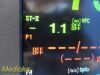 NIHON KOHDEN 2018  Lifescope BSM 6000 ,W/ AY-653P Module & Leads ~ Monitor
