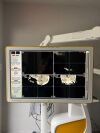 BRAINLAB 19900 Navigation Station Curve Dual Display   - Cranial Software 2.0