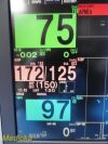 NIHON KOHDEN BSM-6501A Neonatal ICU ,W/ AY-653P Module & New Leads ~ Monitor