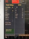 GE Datex-Ohmeda Avance S/5 Anesthesia Machine