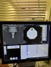 SIEMENS SOMATOM Emotion CT Scanner