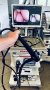 PENTAX EPK-i7000 Pentax EPK-i7000 endoscopy tower