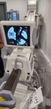 OEC 9900 "PM CARES" C-Arm