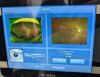 OPTOS 200T DAYTONA Fundus Camera