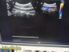 PHILIPS C9-4 P/N 453561212363 Convex Array Ultrasound Transducer