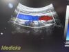 PHILIPS C9-4 P/N 453561212363 Convex Array Ultrasound Transducer