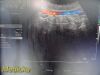 SIEMENS/ACUSON 2011 Siemens 4C1 Convex Array Probe, P/N 08259644 ~ Ultrasound Transducer