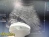 SIEMENS/ACUSON 2011 Siemens 4C1 Convex Array Probe, P/N 08259644 ~ Ultrasound Transducer