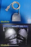 PHILIPS IU-22 S4-1 Phased Array Ultrasound Probe 4000-0966-02 (TESTED) / Ultrasound Transducer