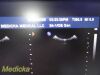 PHILIPS IU-22 S4-1 Phased Array Ultrasound Probe 4000-0966-02 (TESTED) / Ultrasound Transducer