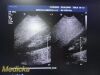 PHILIPS IU-22 S4-1 Phased Array Ultrasound Probe 4000-0966-02 (TESTED) / Ultrasound Transducer