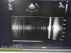 PHILIPS S5-1 P/N 21314A Sector Array Ultrasound Transducer