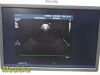 PHILIPS S5-1 P/N 21314A Sector Array Ultrasound Transducer