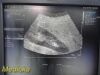 SIEMENS/ACUSON 2013 Siemens 4C1 Convex Array Ultrasound Transducer