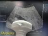 SIEMENS/ACUSON 2013 Siemens 4C1 Convex Array Ultrasound Transducer