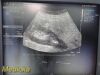 SIEMENS/ACUSON 2013 Siemens 4C1 Convex Array Ultrasound Transducer