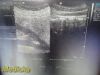 SIEMENS/ACUSON 2013 Siemens 4C1 Convex Array Ultrasound Transducer