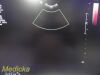PHILIPS IU-22 S4-1 Sector Array Ultrasound Probe 4000-0966-02 (TESTED)/ Ultrasound Transducer