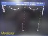 PHILIPS IU-22 S4-1 Sector Array Ultrasound Probe 4000-0966-02 (TESTED)/ Ultrasound Transducer