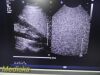PHILIPS IU-22 S4-1 Sector Array Ultrasound Probe 4000-0966-02 (TESTED)/ Ultrasound Transducer
