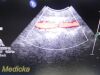 PHILIPS IU-22 S4-1 Sector Array Ultrasound Probe 4000-0966-02 (TESTED)/ Ultrasound Transducer