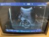 HITACHI EUP-C514 Ultrasound Transducer