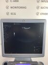 GE Logiq S7 Expert 