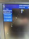 GE HEALTHCARE Vivid i Ultrasound with Convex 4C-RS Cardiac 3S RS 2 Probes Portable Ultrasound