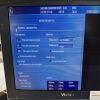 GE HEALTHCARE Vivid i Ultrasound with Convex 4C-RS Cardiac 3S RS 2 Probes Portable Ultrasound