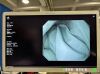 OLYMPUS GIF-H290 Gastroscope
