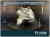 PHILIPS C5-1 CURVED ARRAY ULTRASOUND TRANSDUCER PROBE FOR IU22 / IE33 453561224463 TESTED Ultrasound Transducer