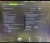 GE VOULSON E10 Ultrasound Transducer