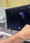 GE VOULSON E10 Ultrasound Transducer
