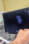 GE VOULSON E10 Ultrasound Transducer