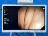OLYMPUS GIF-HQ290 HD Endoscope