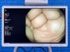 OLYMPUS Scope Model: CF-HQ290L Colonoscope