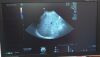 GE C2-9-RS Ultrasound Transducer